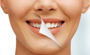 burnos higiena, dantų priežiūra klikshop.lt